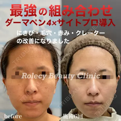 ロレシー美容クリニック 心斎橋駅前院 福留院長医師の症例