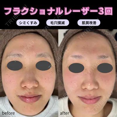 滋賀美容皮膚科クリニックの症例
