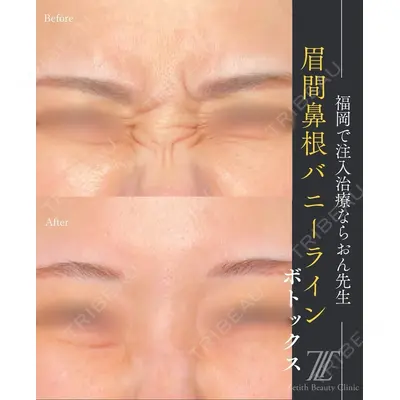 Zetith Beauty Clinic 福岡院の症例