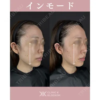 Clinic K Blossomの症例