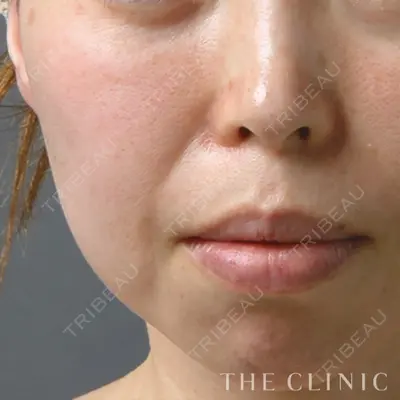 THE CLINIC（ザ・クリニック） 東京院の症例