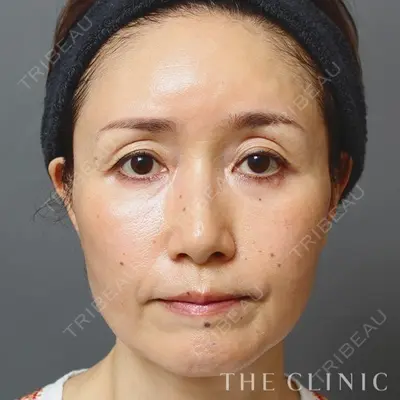 THE CLINIC（ザ・クリニック） 東京院の症例