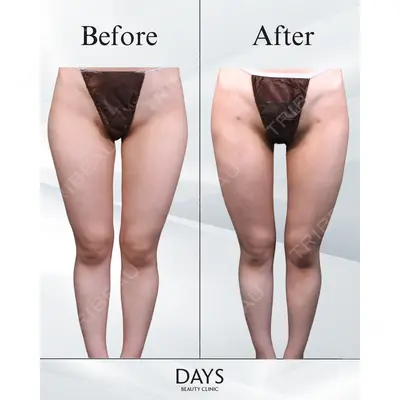 Days Beauty Clinic 本厚木院の症例