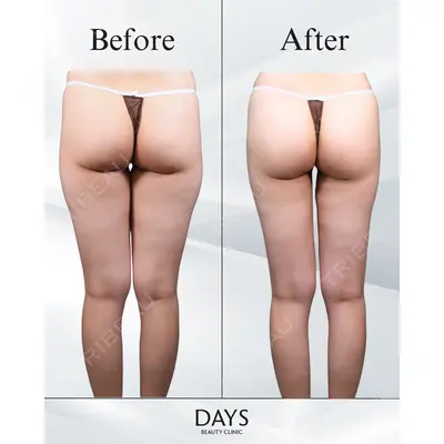 Days Beauty Clinic 本厚木院の症例