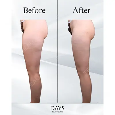 Days Beauty Clinic 本厚木院の症例