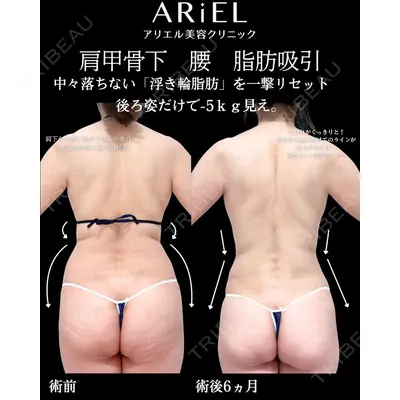 アリエル美容クリニック 横浜院 加藤 敏次医師の症例