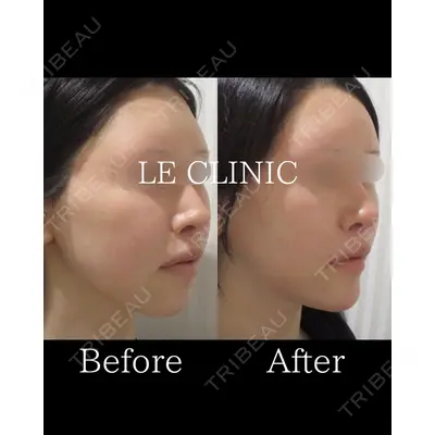 LE CLINICの症例