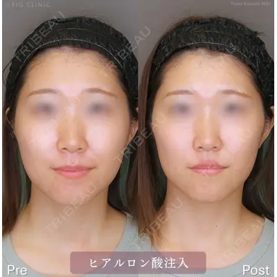 FIG CLINIC 喜多村 勇大朗医師の症例
