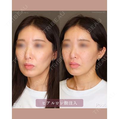 FIG CLINIC 喜多村 勇大朗医師の症例