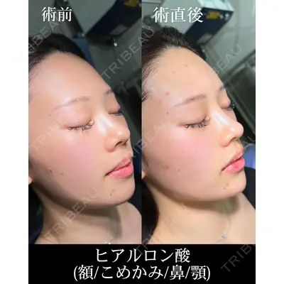 HAAB×DREAM BEAUTY CLINIC 大阪梅田院 柏木 太雅医師の症例