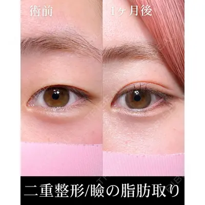 HAAB×DREAM BEAUTY CLINIC 大阪梅田院 柏木 太雅医師の症例