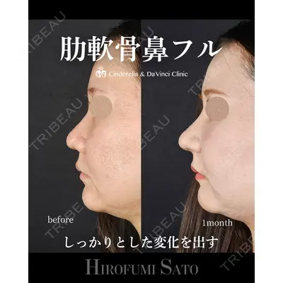シンデレラ＆ダヴィンチクリニック 佐藤 博文医師の症例