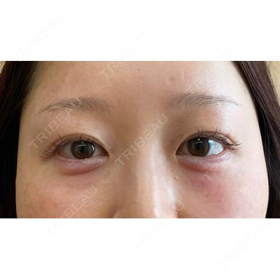Evergreen medical clinic 沼田 櫻華医師の症例