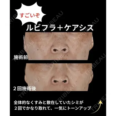 下北沢スキンクリニックの症例