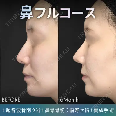 ジョウクリニック 銀座院 重本　譲医師の症例