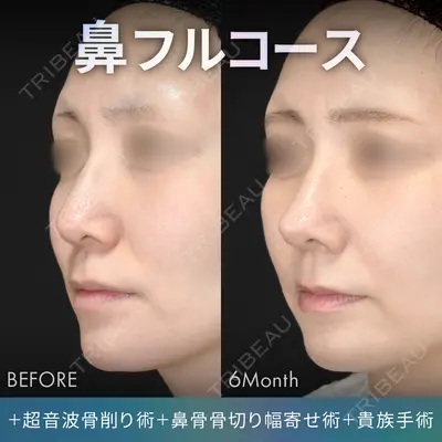 ジョウクリニック 銀座院 重本　譲医師の症例