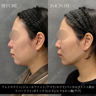 RIVER CLINIC（リバークリニック）大阪院 木家 佑理子医師の症例