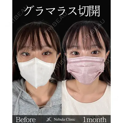ネビュラクリニック 東京錦糸町院 岩切 琢磨医師の症例