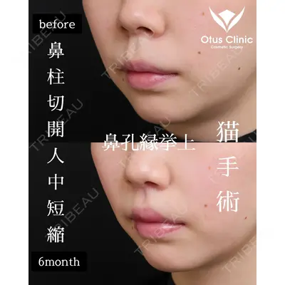 Otus Clinic 【オータスクリニック】 中 徳太郎医師の症例