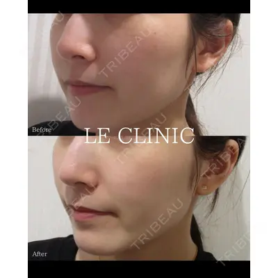 LE CLINICの症例