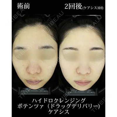HAAB CLINIC 池袋院の症例