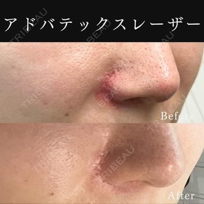 東京ココセランクリニック 篠﨑 智公医師の症例