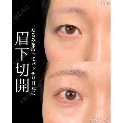 新宿美容外科ネビュラクリニック 山本 紘子医師の症例