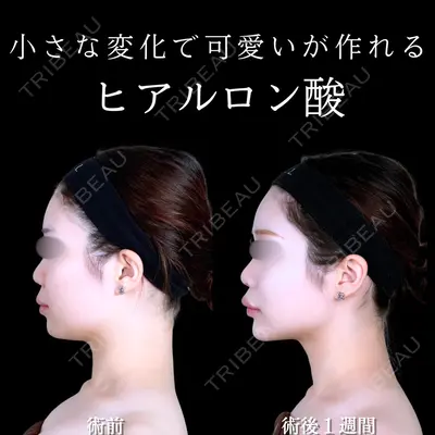 アリエル美容クリニック 水戸院 天白 典秀医師の症例