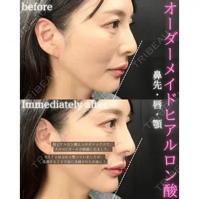 THE FIRST CLINIC 町田院の症例