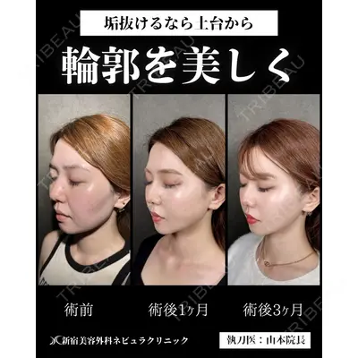 新宿美容外科ネビュラクリニック 山本 紘子医師の症例