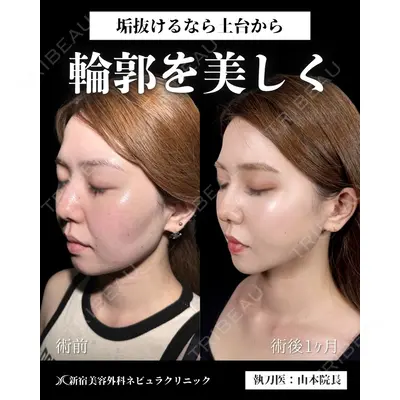 新宿美容外科ネビュラクリニック 山本 紘子医師の症例