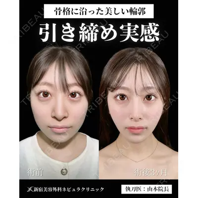 新宿美容外科ネビュラクリニック 山本 紘子医師の症例