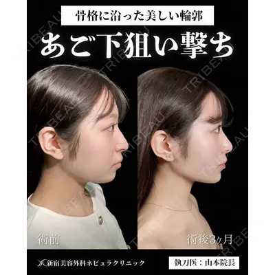 新宿美容外科ネビュラクリニック 山本 紘子医師の症例