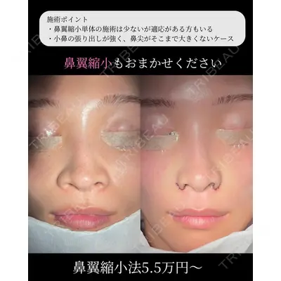 Zetith Beauty Clinic 福岡院 羽根 和秀医師の症例