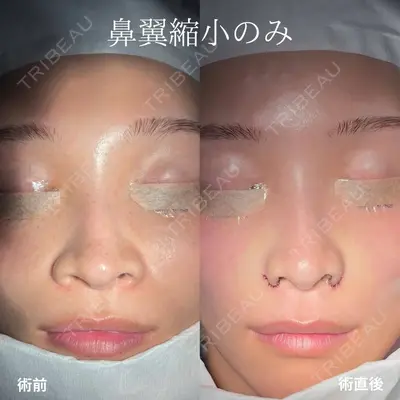 Zetith Beauty Clinic 福岡院 羽根 和秀医師の症例