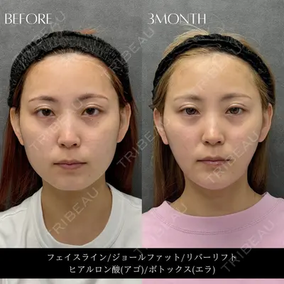 RIVER CLINIC（リバークリニック）大阪院 木家 佑理子医師の症例