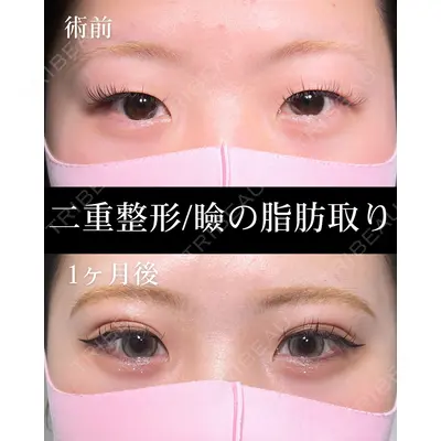 HAAB×DREAM BEAUTY CLINIC 大阪梅田院 柏木 太雅医師の症例