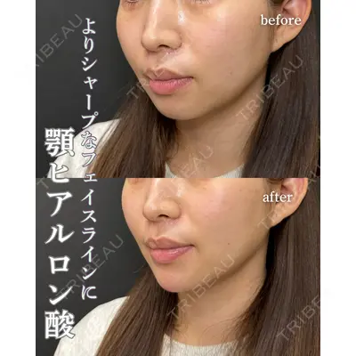 ルラ美容クリニック 岐阜院 馬場 愛理医師の症例
