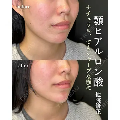 ルラ美容クリニック 岐阜院 馬場 愛理医師の症例