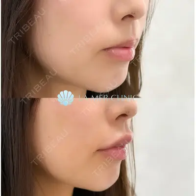 LA MER CLINIC 辻 航平医師の症例
