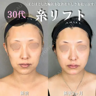 アリエル美容クリニック 大宮院 鈴木　桂介医師の症例