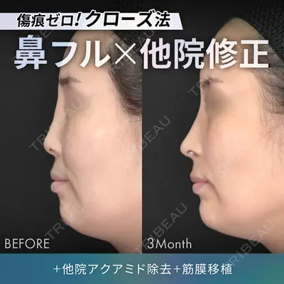 ジョウクリニック 銀座院 重本　譲医師の症例