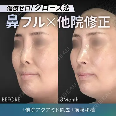 ジョウクリニック 銀座院 重本　譲医師の症例