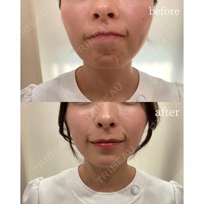 REVO CLINIC PLUS 結城 直哉医師の症例