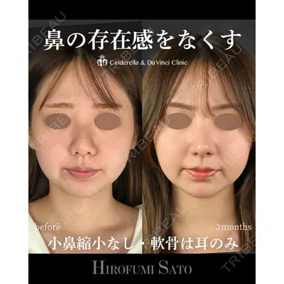 シンデレラ＆ダヴィンチクリニック 佐藤 博文医師の症例