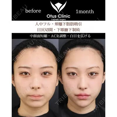 Otus Clinic 【オータスクリニック】 中 徳太郎医師の症例