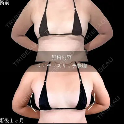 アリエル美容クリニック 横浜院 加藤 敏次医師の症例