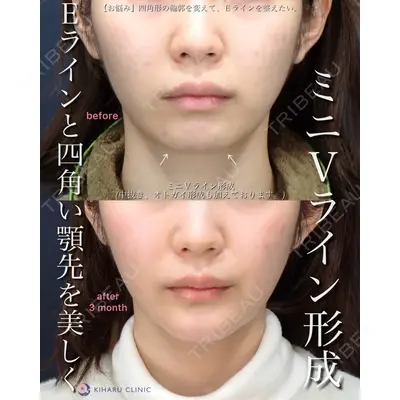 KIHARU CLINIC 沖野 尚秀医師の症例