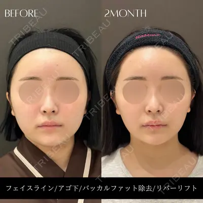 RIVER CLINIC（リバークリニック）大阪院の症例