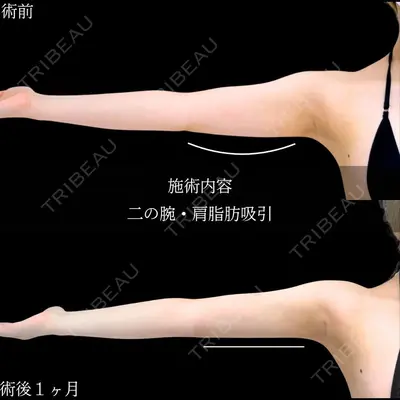 アリエル美容クリニック 横浜院 加藤 敏次医師の症例